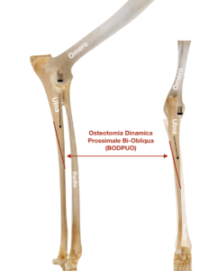 BODPUO osteotomia Dinamica Prossimale Bi-Obliqua