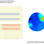 EEG con mappa focale
